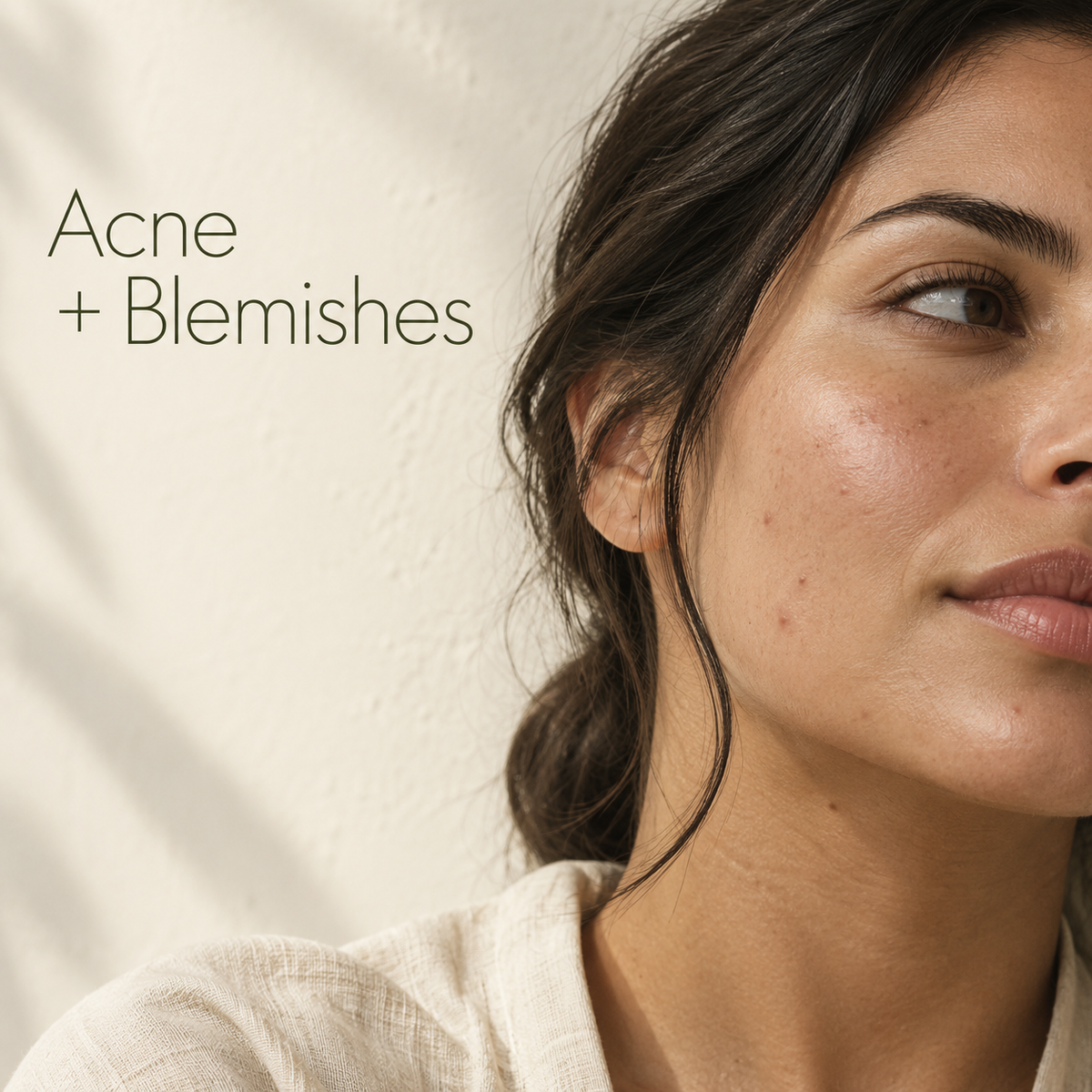 Acne & Blemishes